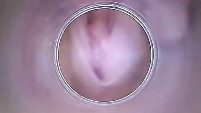 Amadora Europeia Revela Sua Vagina Seca E Colo Do Útero Em Hd